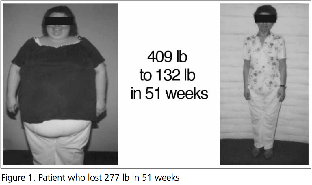 Before and after fasting photos